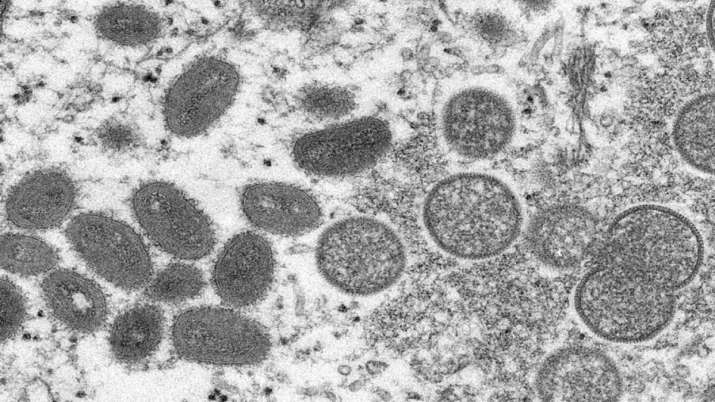 Nearly 200 cases of monkeypox in more than 20 countries